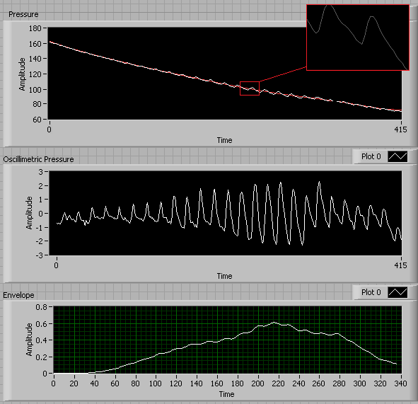 Oscillometry.png